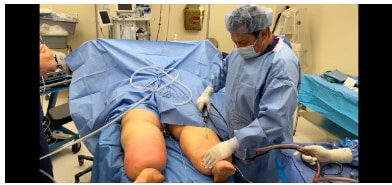 1769705287_l6 Lipedema Overview in West Long Branch, NJ