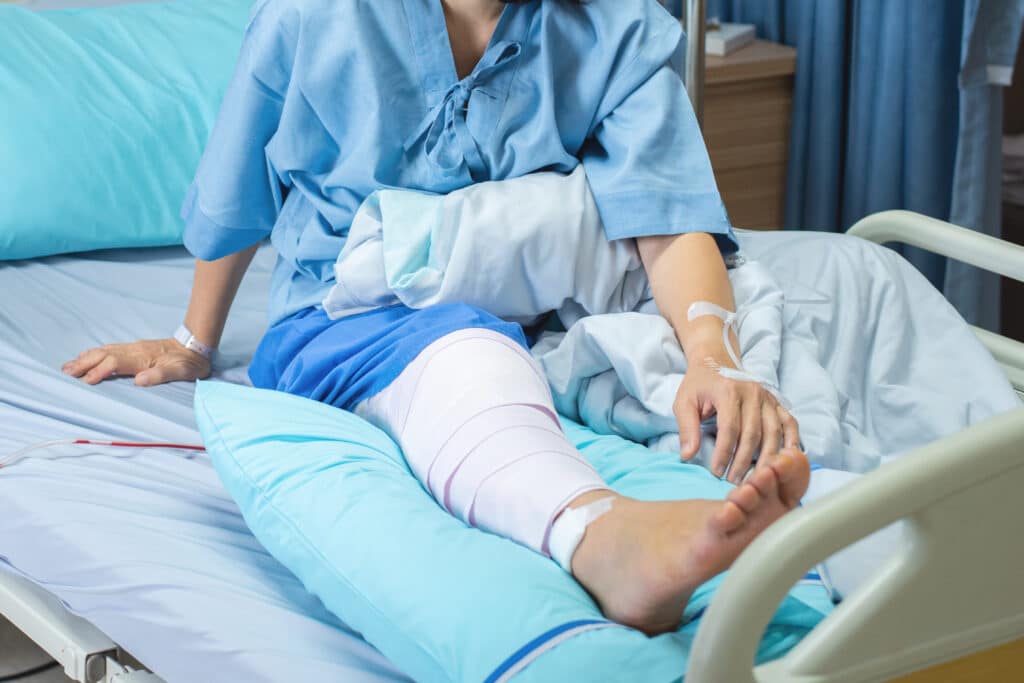 Asian senior or elderly old woman patient lying with bandage compression knee brace support injury on the bed in nursing ward hospital.