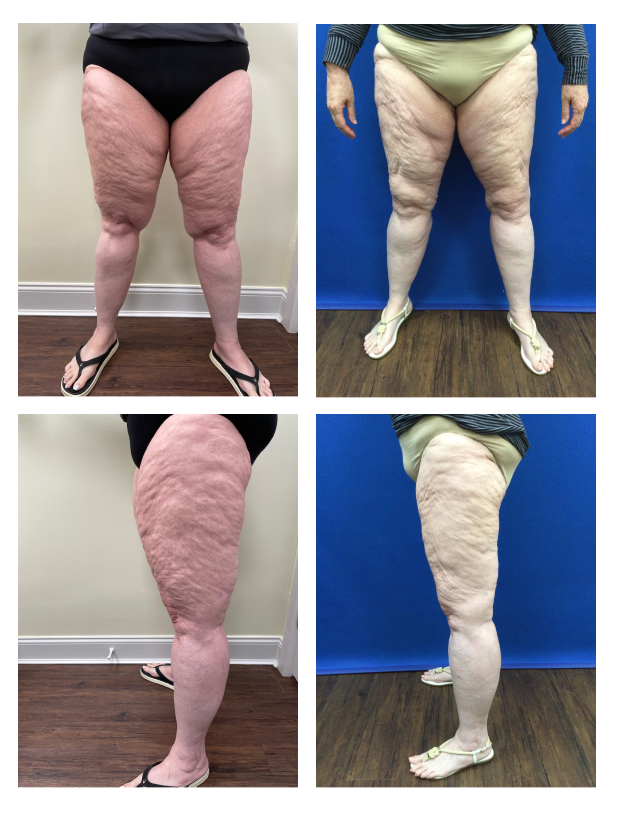 Before and After Image: Patient 1 - other