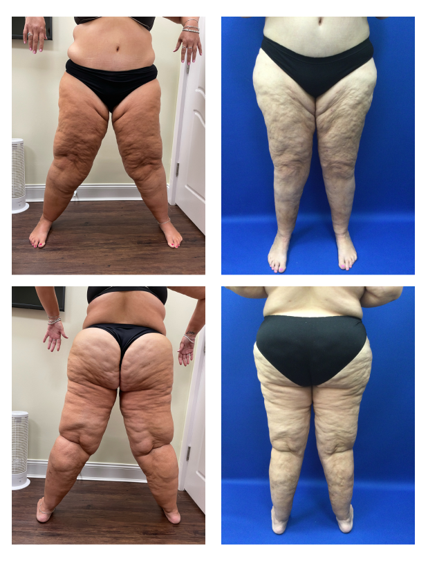 Before and After Image: Patient 2 - other