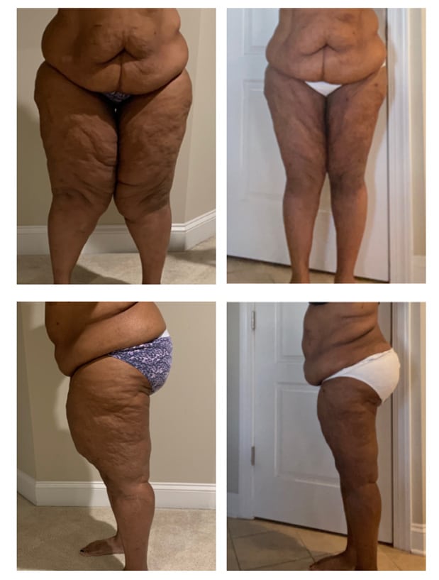 Before and After Image: Patient 3 - other