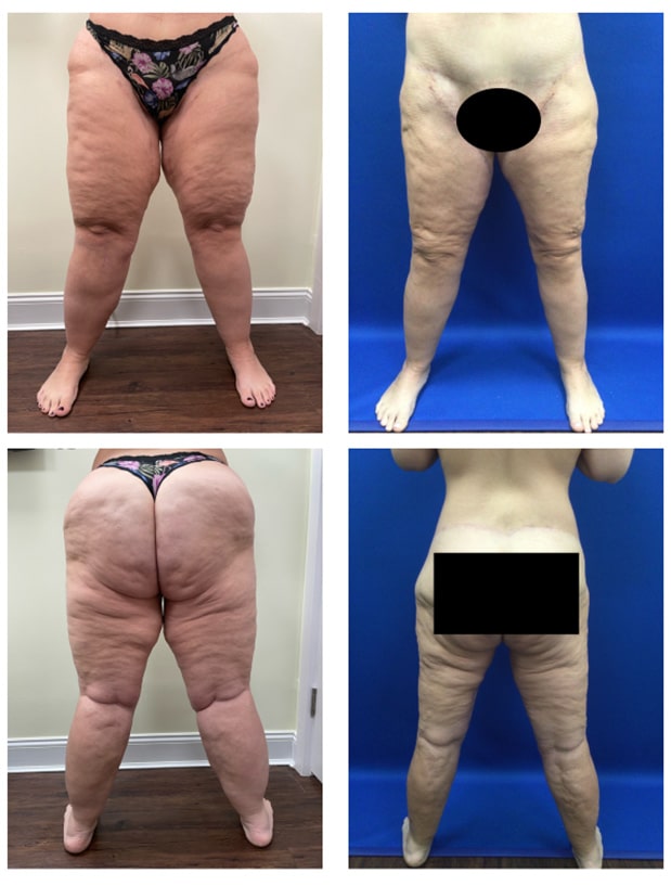 Before and After Image: Patient 4 - other