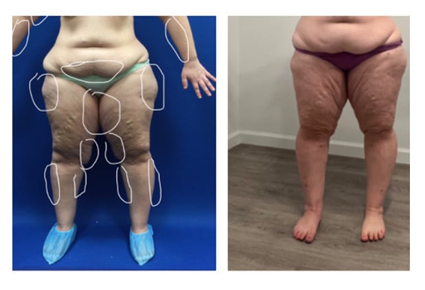 Before and After Image: Patient 7 - front