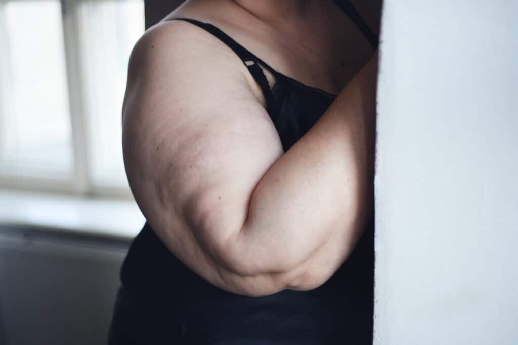 Cut out of lonely fat woman in underwear at home. Close-up of a woman's arm who is suffering from Lipedema fatty deposits, in need of an arm lift.